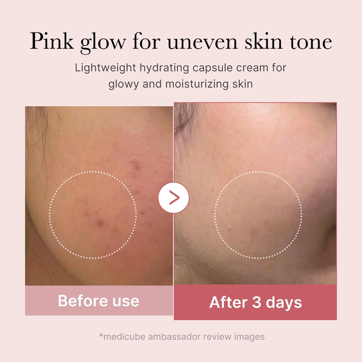 medicube Capsule Cream with Salmon DNA PDRN Pink Collagen | Lightweight Moisturizing Cream with PDRN, Niacinamide for Uneven Skin Tone and Texture, Glow hydration | Korean Skincare, 1.94 oz
