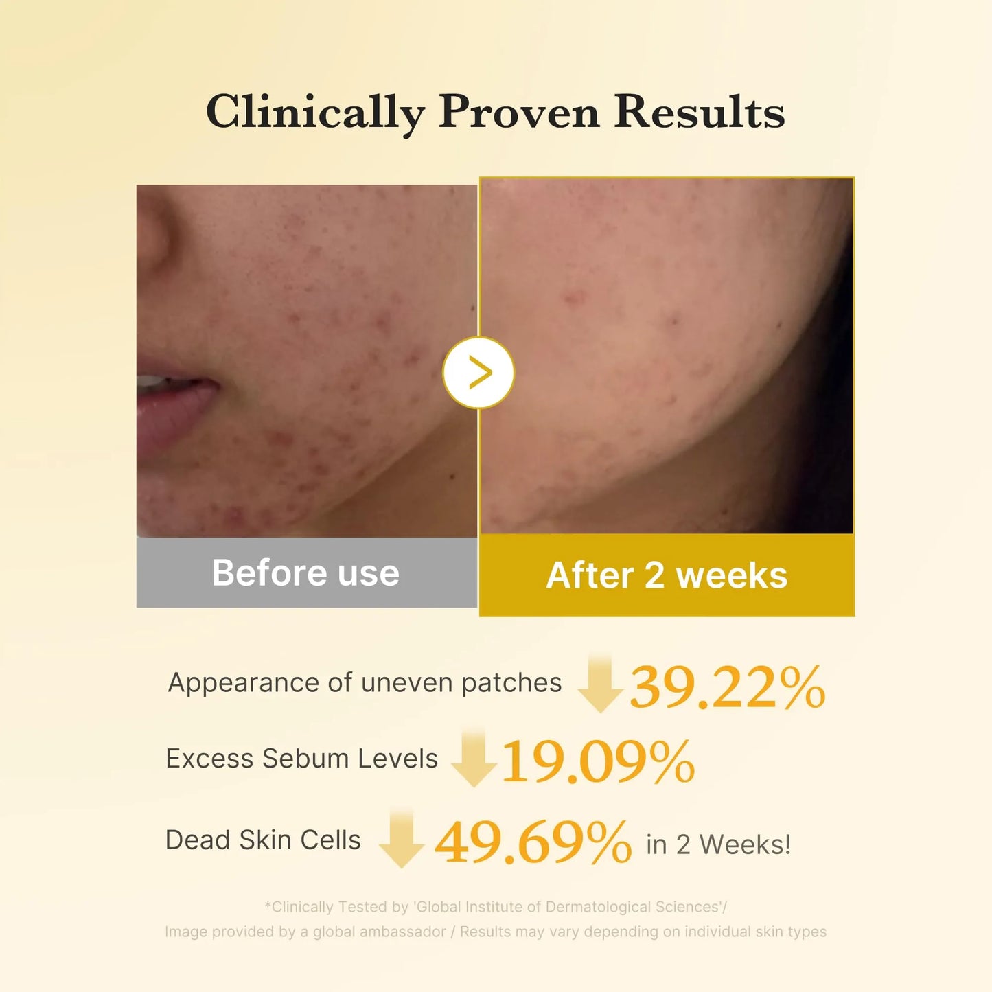 medicube Kojic Acid Renew & Smooth Duo for Troubled Skin: Kojic Acid Turmeric Clarifying Toner Pad and Kojic Acid Turmeric Clarifying & Balancing Capsule Serum, Valentines Day Gifts for Her