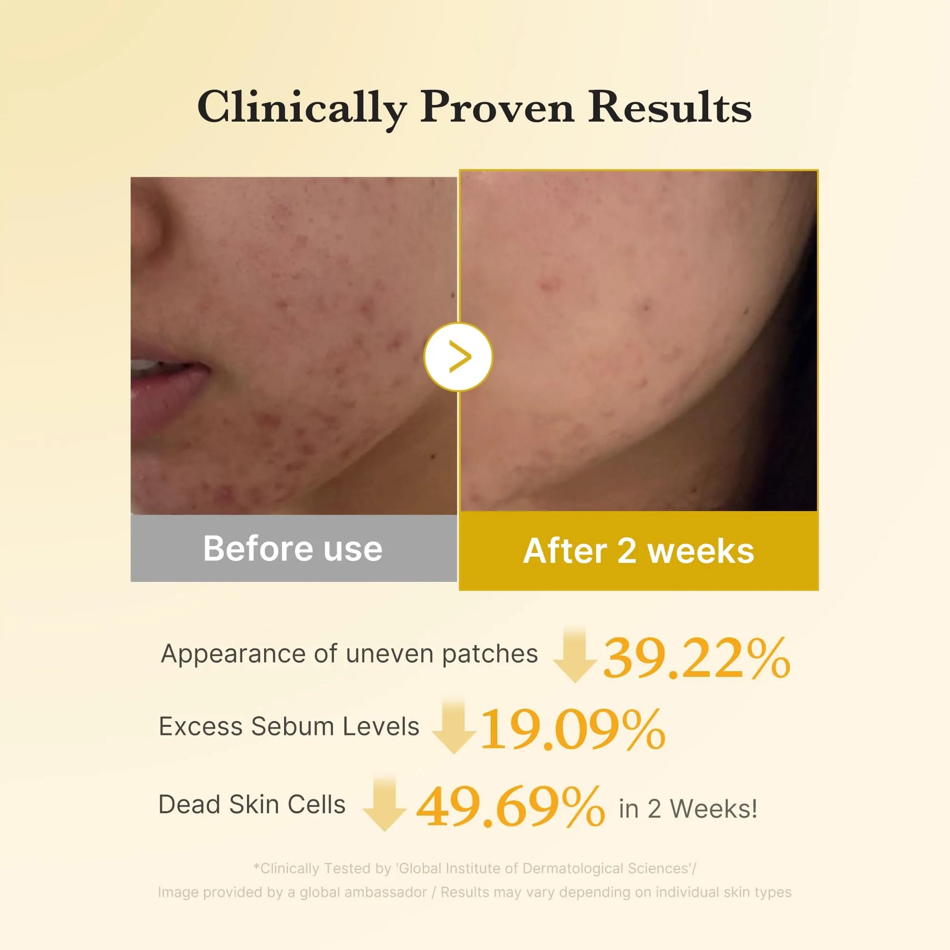 medicube Kojic Acid Renew & Smooth Duo for Troubled Skin: Kojic Acid Turmeric Clarifying Toner Pad and Kojic Acid Turmeric Clarifying & Balancing Capsule Serum, Valentines Day Gifts for Her