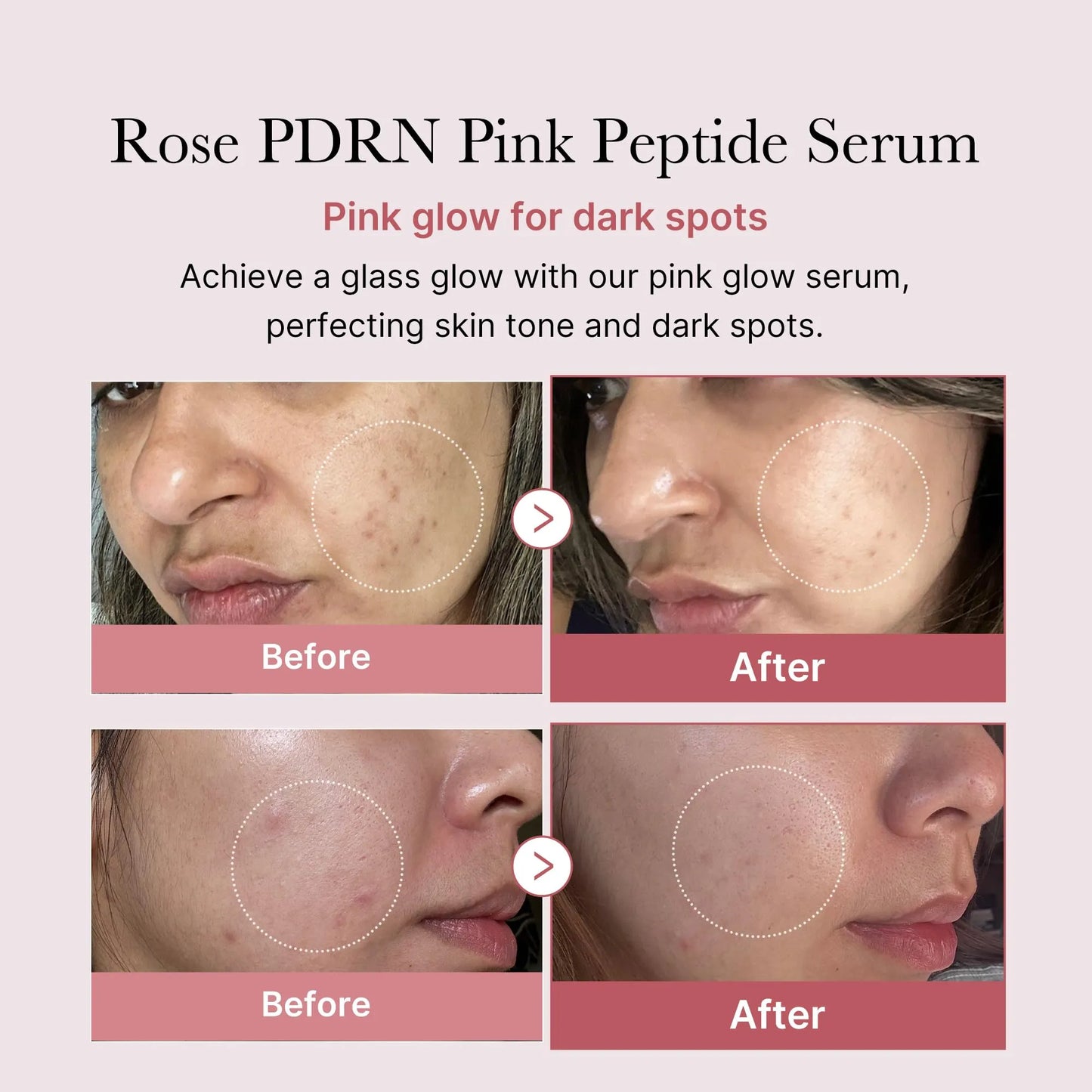 medicube Viral Serum Duo for Clear and Plump Skin: Kojic Acid Turmeric and PDRN Rose Pink Serum for Radiant Glow and Uneven Skin Tone & Texture Care | Giftable Skincare Set