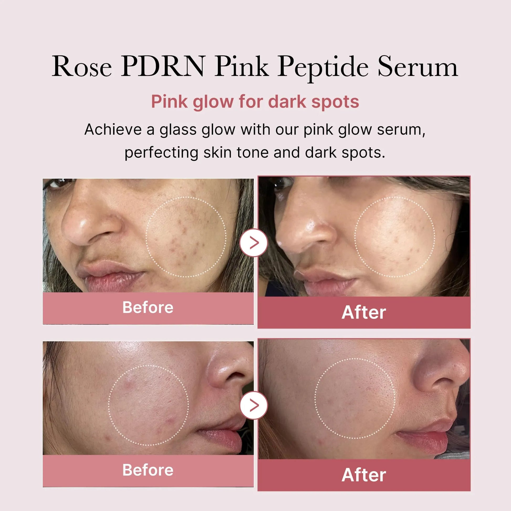 medicube Viral Serum Duo for Clear and Plump Skin: Kojic Acid Turmeric and PDRN Rose Pink Serum for Radiant Glow and Uneven Skin Tone & Texture Care | Giftable Skincare Set