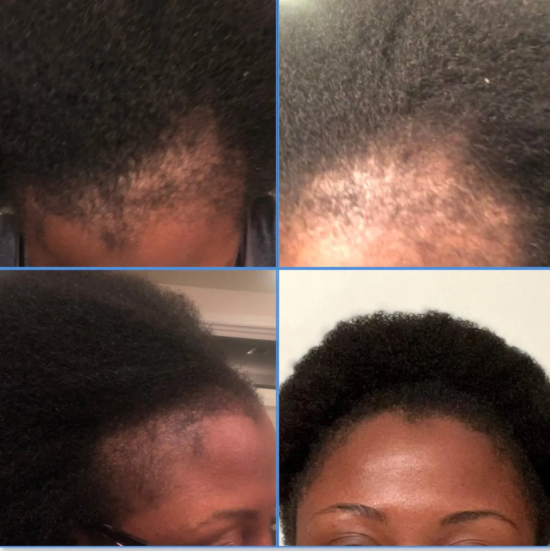 Iyami Black Witch Mega Hair Growth Oil