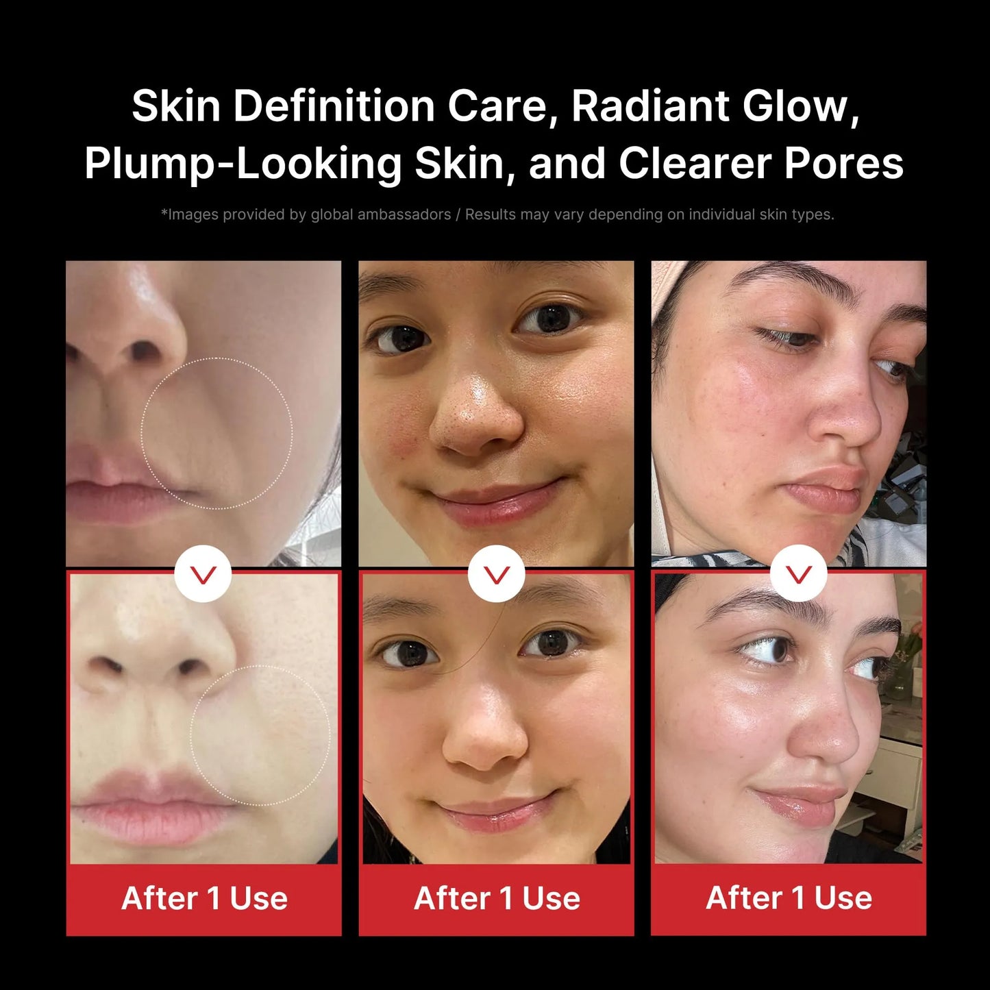 medicube Hydration Boost Facial Device Set: Hyaluronic Acid Moisturizing Jelly Cream and Booster Pro Black | For Radiant and Firmer-Looking Glow | Home Care, Korean Skincare